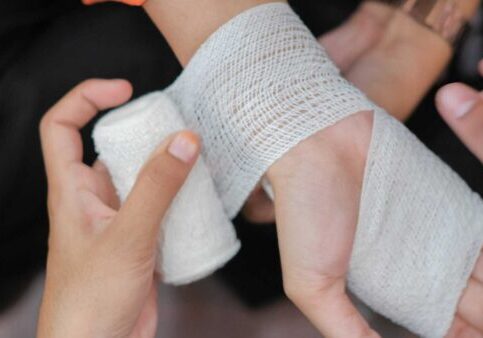 burn-injury